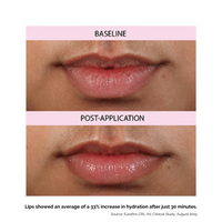 lip treatment trio (multi-color) travel set